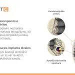 Remedium-ROOTT-implanti-4.jpg